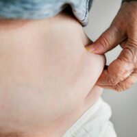 Person pinching body fat on stomach